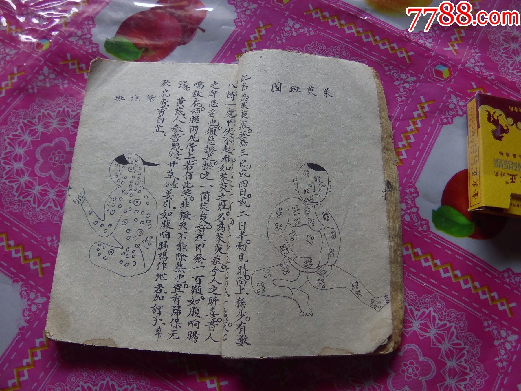小兒痘麻摘要_價格921元_第9張_