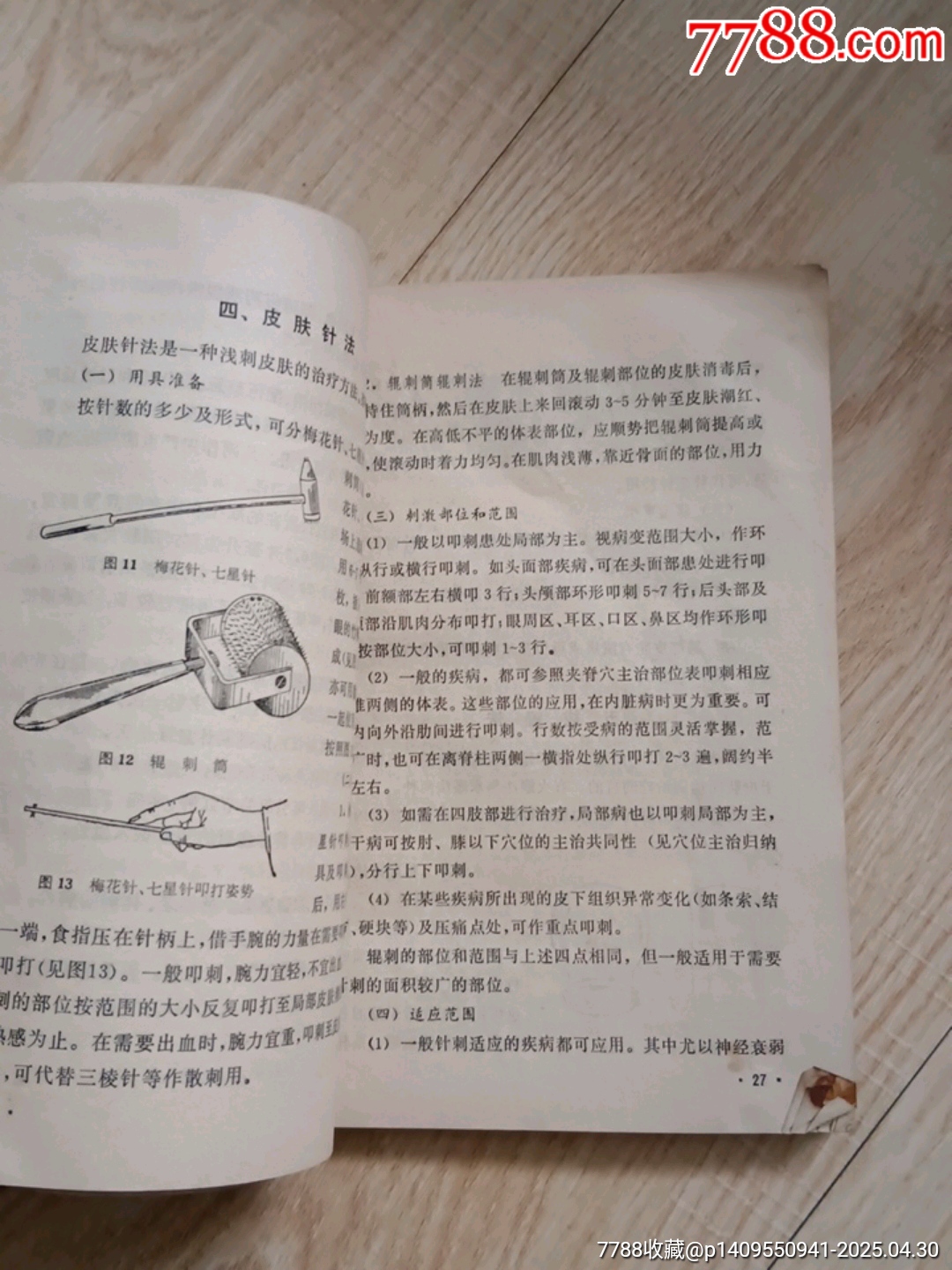 針灸治療手冊(cè)_價(jià)格1元【山西老舊貨】_第8張_